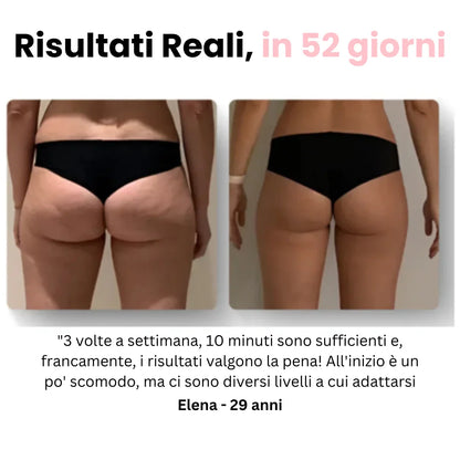 Velora™ - Anti Cellulite Massaggiatore