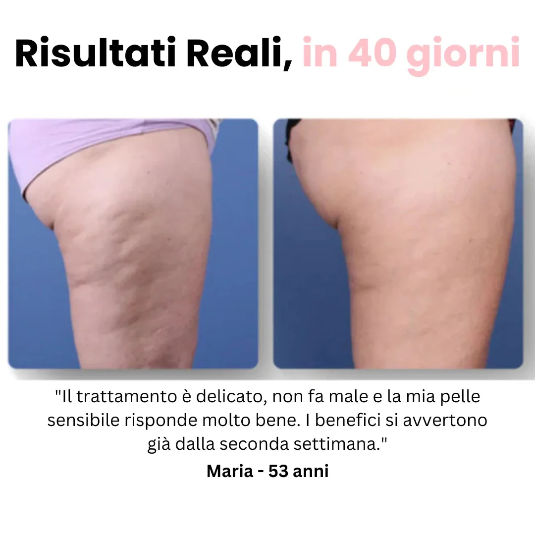 Velora™ - Anti Cellulite Massaggiatore