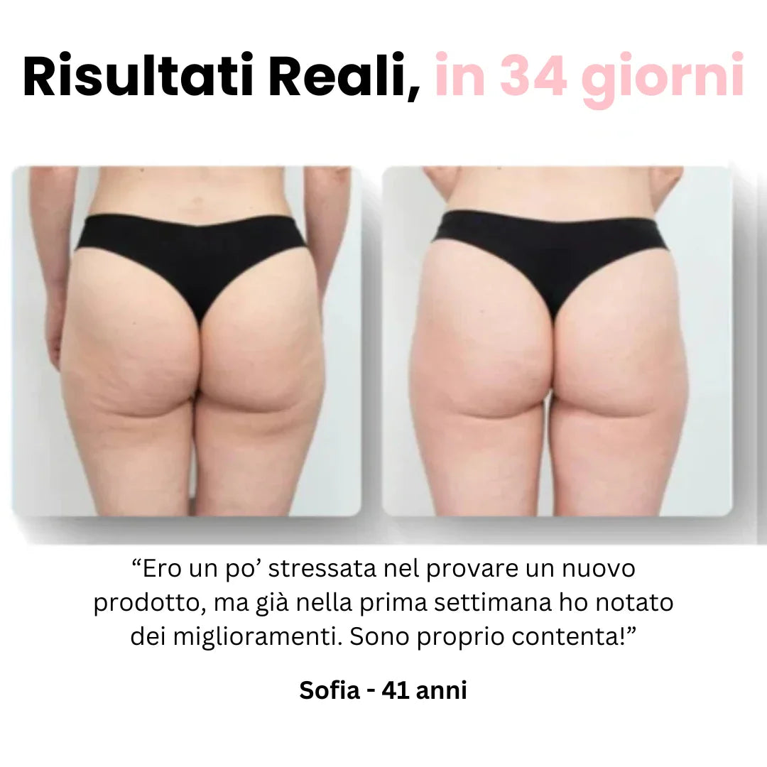 Velora™ - Anti Cellulite Massaggiatore